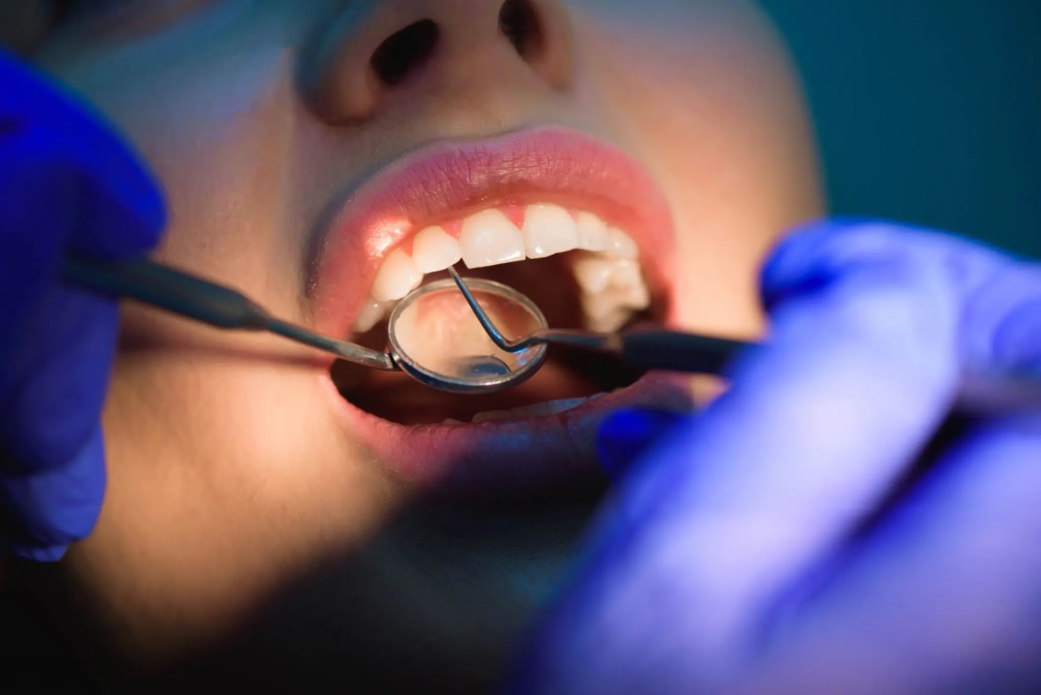 Periodontoloji